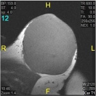 Zoom image: Radiological image