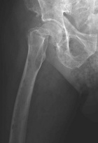 Zoom image: Radiological image