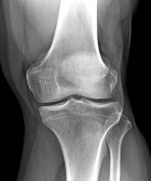 Zoom image: Radiological image