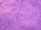 Zoom image: Cell stain
