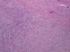 Zoom image: Cell stain