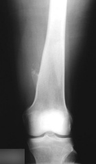 Zoom image: Radiological image