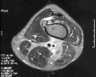 Zoom image: Radiological image