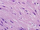 Zoom image: Cell stain