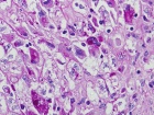 Zoom image: Cell stain