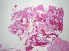 Zoom image: Cell stain