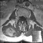 Zoom image: Radiological image