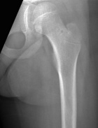 Zoom image: Radiological image