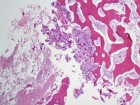 Zoom image: Cell stain