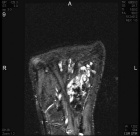 Zoom image: Radiological image