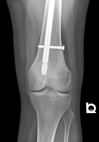 Zoom image: Radiological image