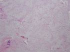 Zoom image: Cell stain