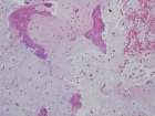 Zoom image: Cell stain