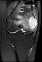 Zoom image: Radiological image