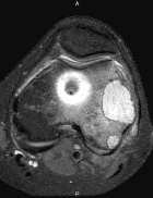 Zoom image: Radiological image