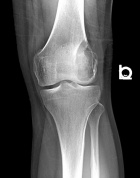 Zoom image: Radiological image