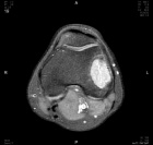 Zoom image: Radiological image