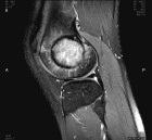 Zoom image: Radiological image
