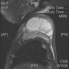 Zoom image: Radiological image