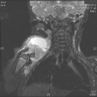 Zoom image: Radiological image