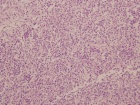Zoom image: Cell stain