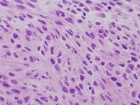 Zoom image: Cell stain