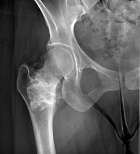 Zoom image: Radiological image