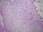 Zoom image: Cell stain