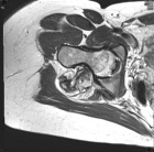 Zoom image: Radiological image