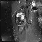 Zoom image: Radiological image