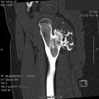 Zoom image: Radiological image