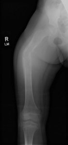 Zoom image: Radiological image