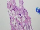 Zoom image: Cell stain