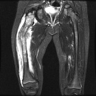 Zoom image: Radiological image