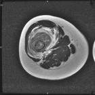 Zoom image: Radiological image