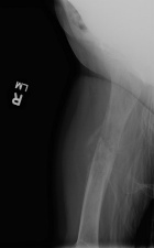 Zoom image: Radiological image