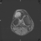 Zoom image: Radiological image