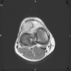 Zoom image: Radiological image