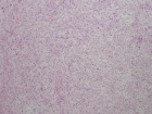 Zoom image: Cell stain