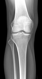 Zoom image: Radiological image