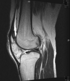 Zoom image: Radiological image