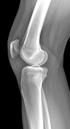 Zoom image: Radiological image