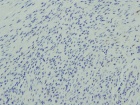 Zoom image: Cell stain