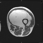 Zoom image: Radiological image