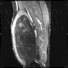 Zoom image: Radiological image