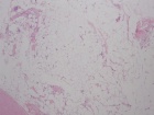 Zoom image: Cell stain