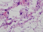 Zoom image: Cell stain