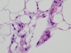 Zoom image: Cell stain
