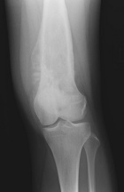 Zoom image: Radiological image