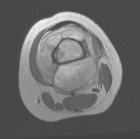 Zoom image: Radiological image
